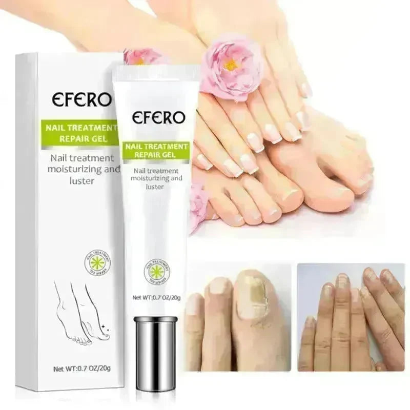 Nail Treatment Serum Nail Foot Nail Fungus Removal Gel Anti Infection Onychomycosis Nail Repair Cream Feet Care - EX-STOCK CANADA