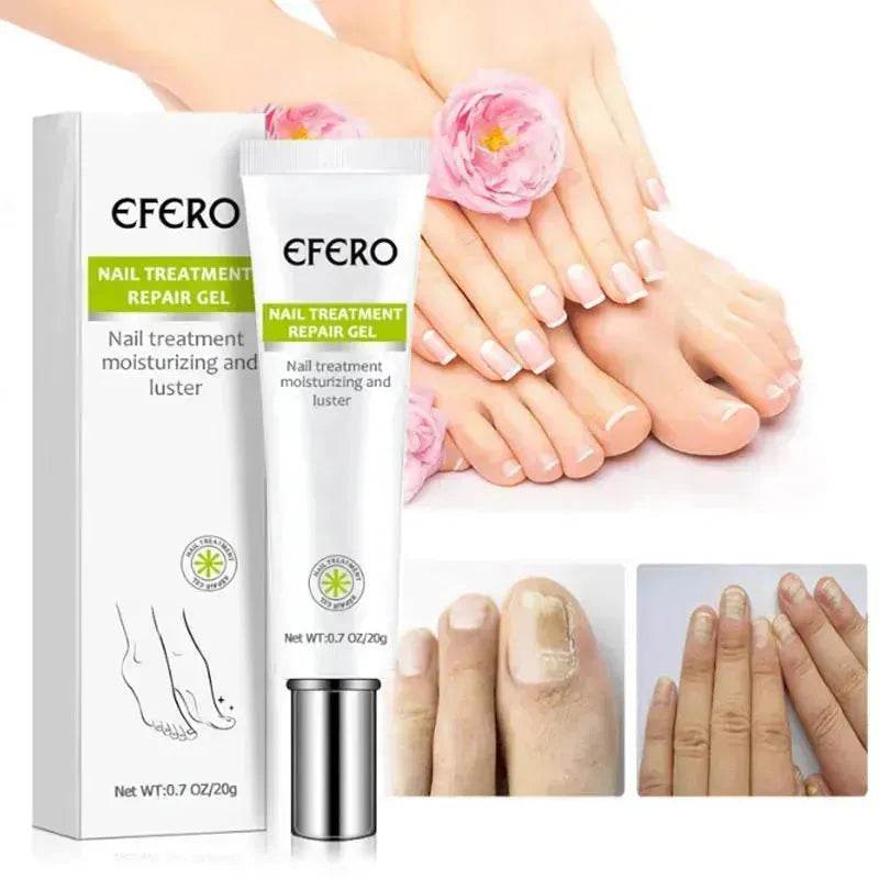 Nail Treatment Serum Nail Foot Nail Fungus Removal Gel Anti Infection Onychomycosis Nail Repair Cream Feet Care - EX-STOCK Canada