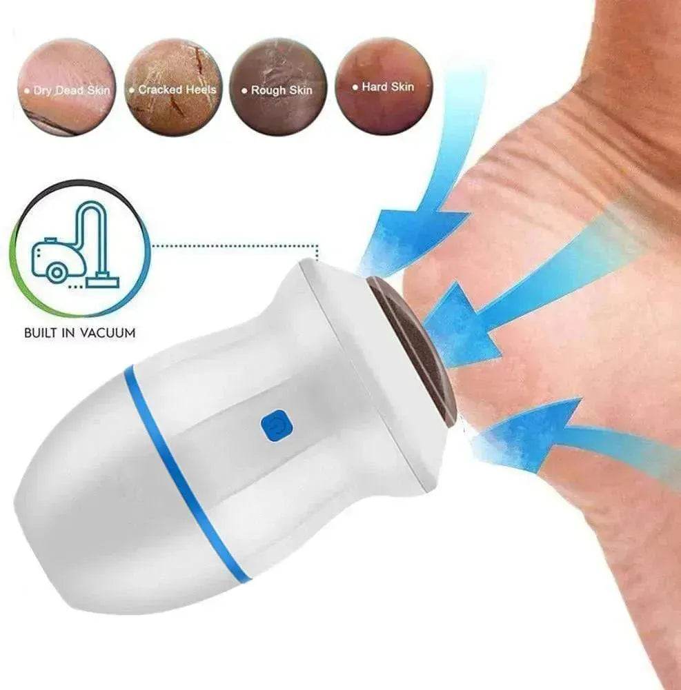 Exfoliate Dead Skin Callus Remover Heel Electric Vacuum Foot Grinder File Machine - EX-STOCK Canada