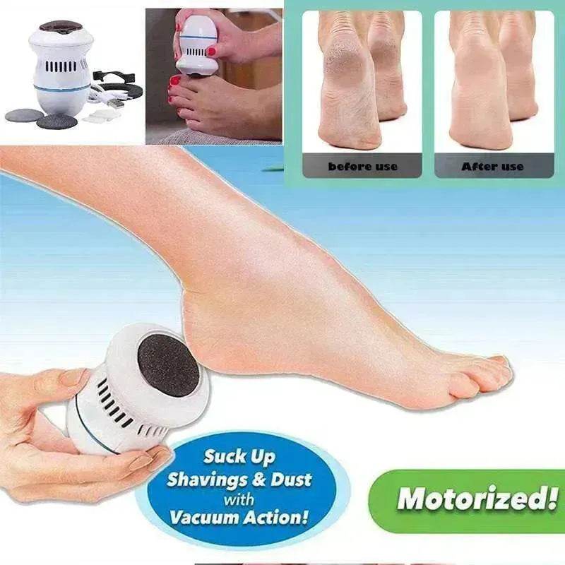 Exfoliate Dead Skin Callus Remover Heel Electric Vacuum Foot Grinder File Machine - EX-STOCK Canada