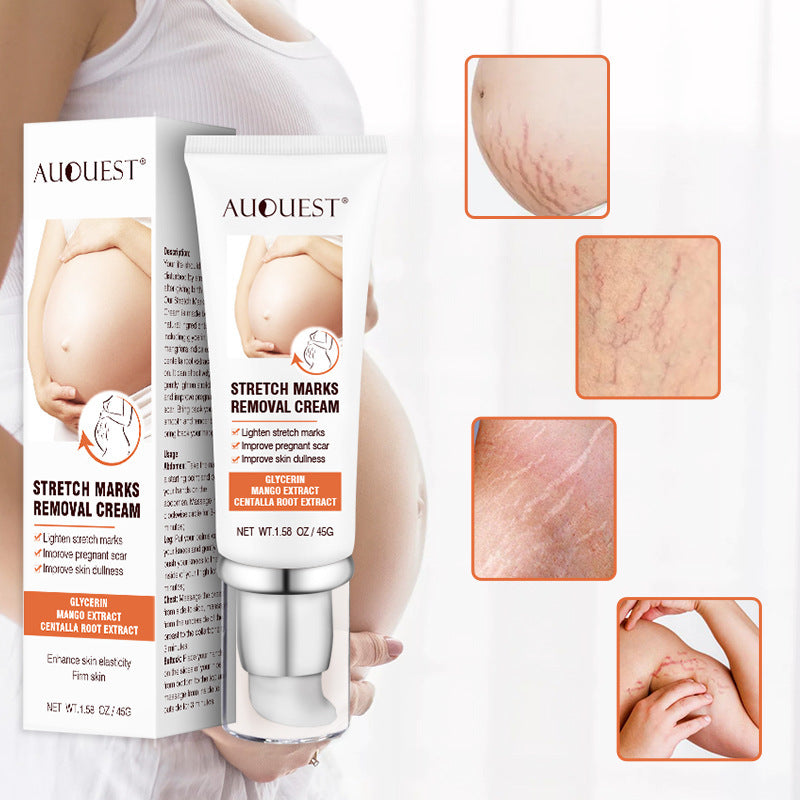 Remove Pregnancy Scars Acne Cream Stretch Mark Treatment Maternity Repair Anti-Aging Anti-Winkle Firming Body Cream EX-STOCK Canada