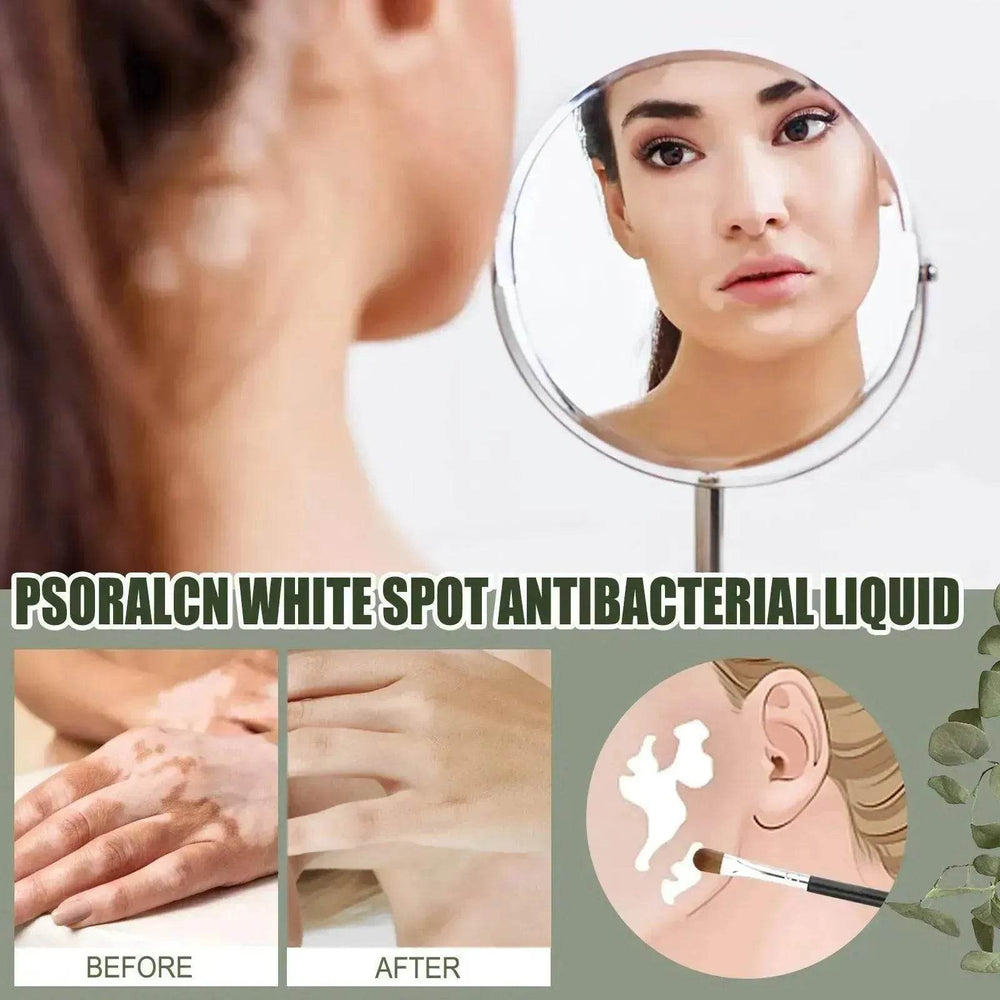 EELHOE White Spot Cleansing Serum PSORALCN White Spot Antibacterial Liquid. - EX-STOCK Canada