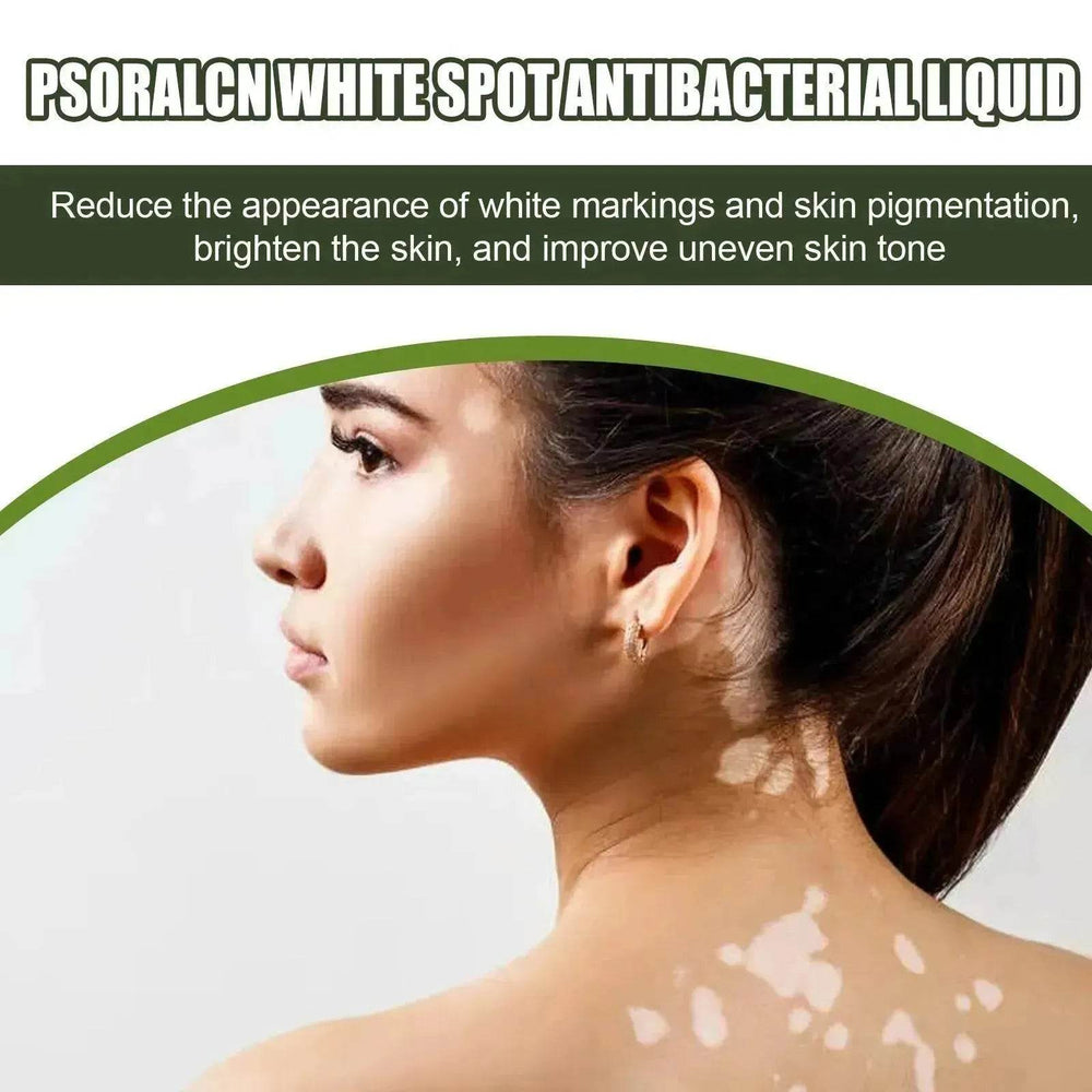 EELHOE White Spot Cleansing Serum PSORALCN White Spot Antibacterial Liquid. - EX-STOCK Canada