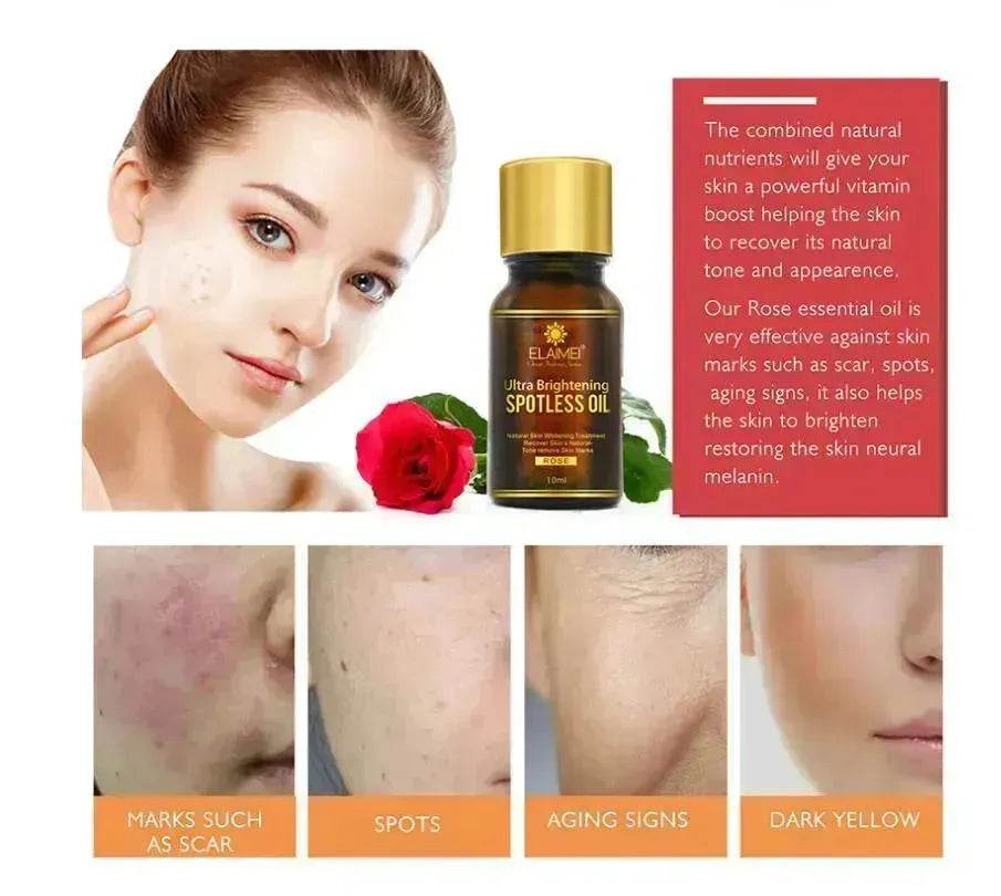 ELAIMEI Ultra Whitening Brightening Spotless Oil Freckles and Dark Spot Remover - EX-STOCK Canada