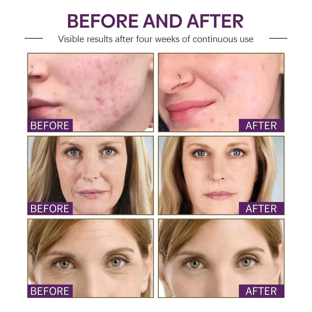 Face Moisturizing Cream Firming Moisturizing Skin Anti-wrinkle - EX-STOCK Canada