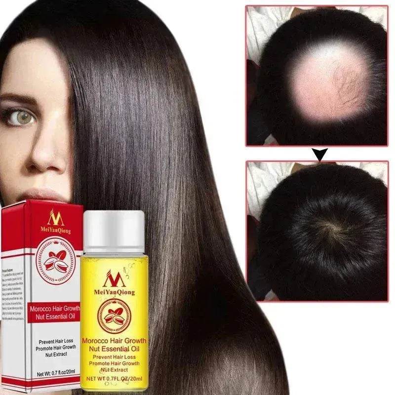 Hair Care Essential Oil , Promote Hair Growth, Shinny smooth texture, Moisturizes hair - EX-STOCK Canada