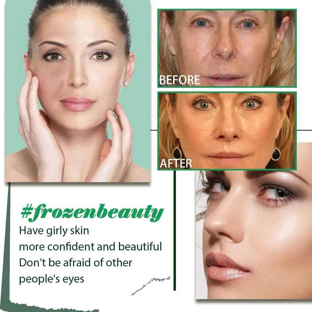 Moisturizing Lifting Fading Wrinkle French Lines Facial Skin The Lifting Face Serum - EX-STOCK Canada