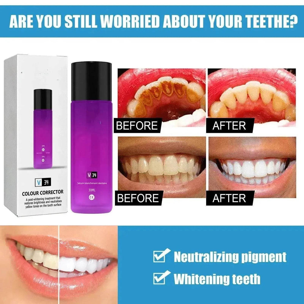 Teeth Whitening Liquid Toothpaste Tooth Stain Removal Oral Care - EX-STOCK Canada