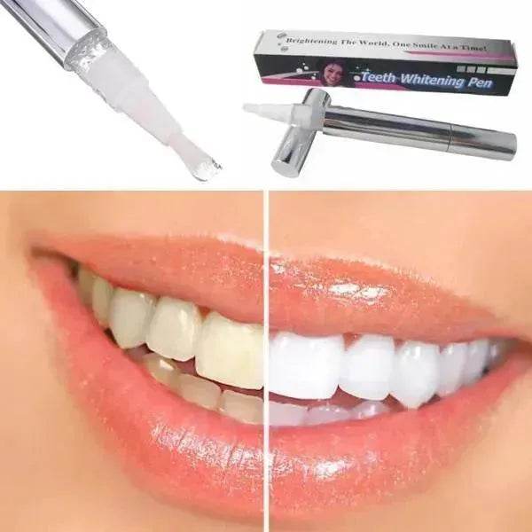 Teeth Whitening Pen - EX-STOCK Canada