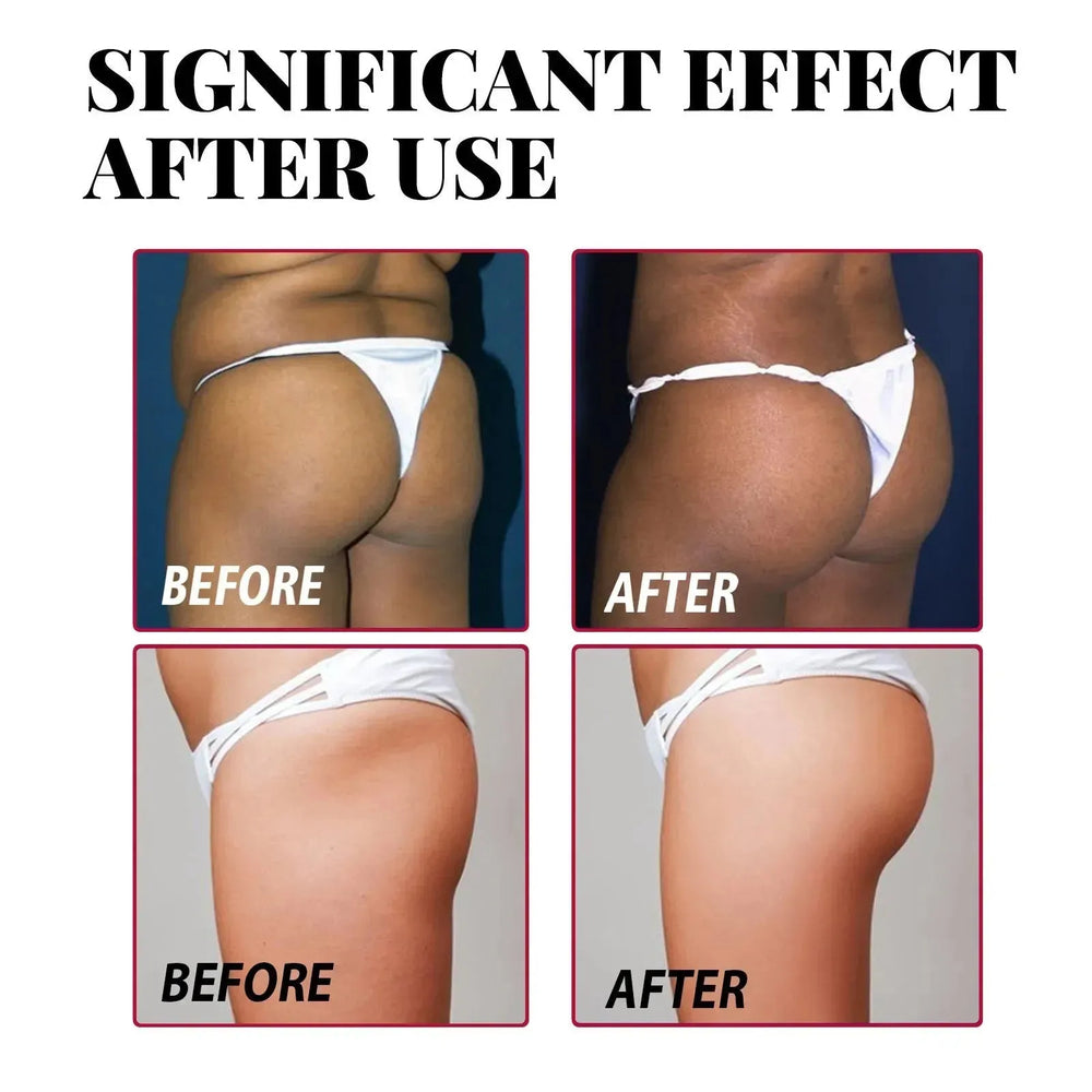 Plump Buttock Cream Lifts And Tightens Buttocks - EX-STOCK CANADA
