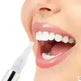 Teeth Whitening Pen - EX-STOCK CANADA