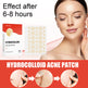 Invisible Breathable Repair Hydrogel Acne Patch 