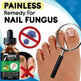 7DAYS Nail Fungus Treatment Serum Care Hand And Foot Care Removal - EX-STOCK CANADA