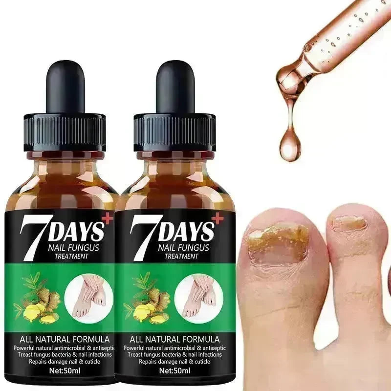 7DAYS Nail Fungus Treatment Serum Care Hand And Foot Care Removal - EX-STOCK CANADA