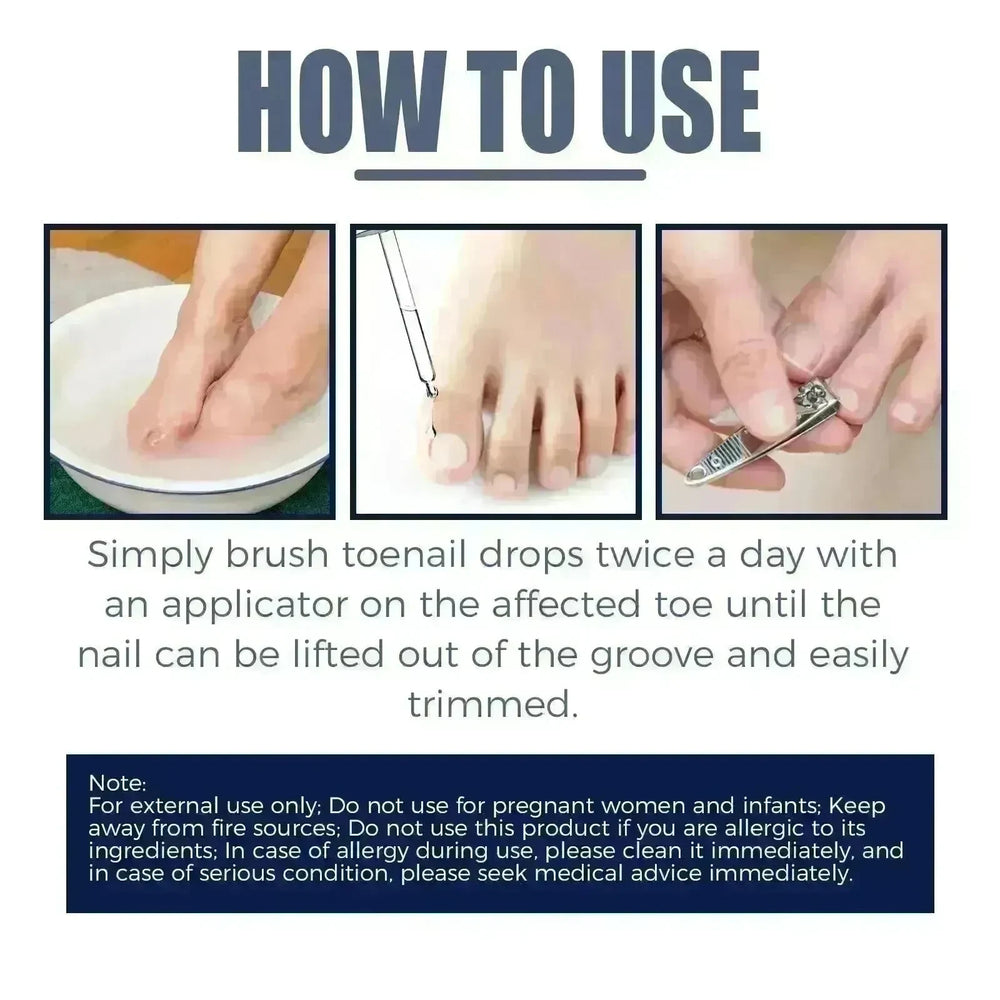 Relieving And Repairing Ingrown Nail Toe Nail Removing Meat Treatment Oil - EX-STOCK CANADA