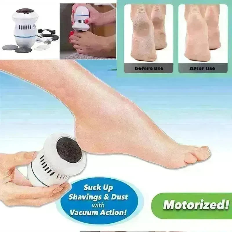 Exfoliate Dead Skin Callus Remover Heel Electric Vacuum Foot Grinder File Machine - EX-STOCK CANADA