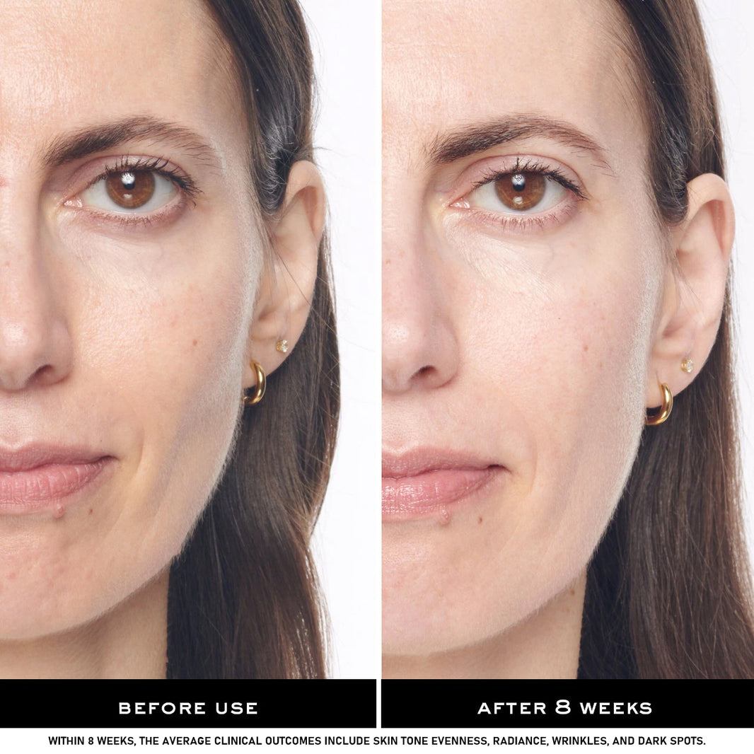 PHOFAY Brightening Skin Whitening Cream – Niacinamide Body Brightener