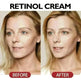 Anti-Aging Nourishing And Firming Skin Anti-wrinkle Face Cream - EX-STOCK CANADA