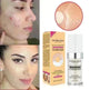 Concealing Foundation Temperature Change Skin Color - EX-STOCK CANADA