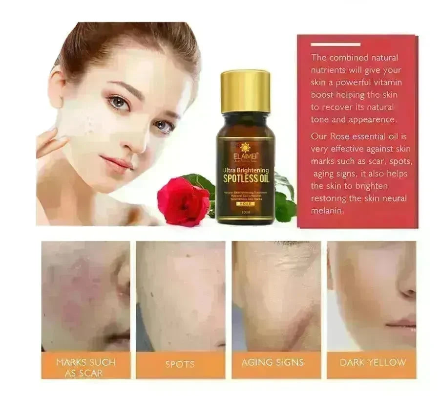 ELAIMEI Ultra Whitening Brightening Spotless Oil Freckles and Dark Spot Remover - EX-STOCK CANADA