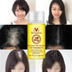 Hair Care Essential Oil , Promote Hair Growth, Shinny smooth texture, Moisturizes hair - EX-STOCK Canada