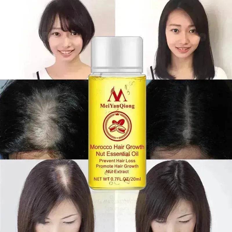 Hair Care Essential Oil , Promote Hair Growth, Shinny smooth texture, Moisturizes hair - EX-STOCK Canada