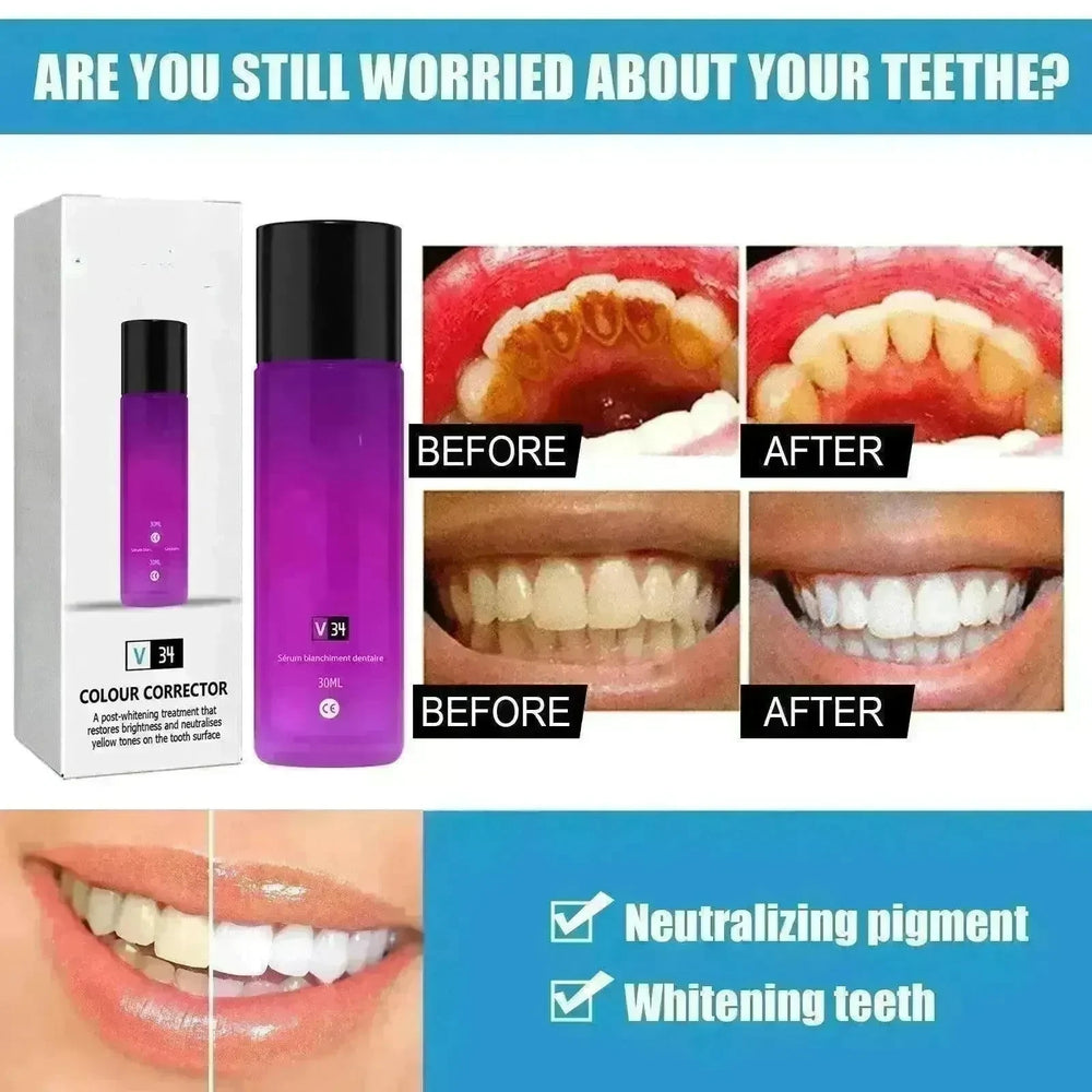 Teeth Whitening Liquid Toothpaste Tooth Stain Removal Oral Care - EX-STOCK CANADA